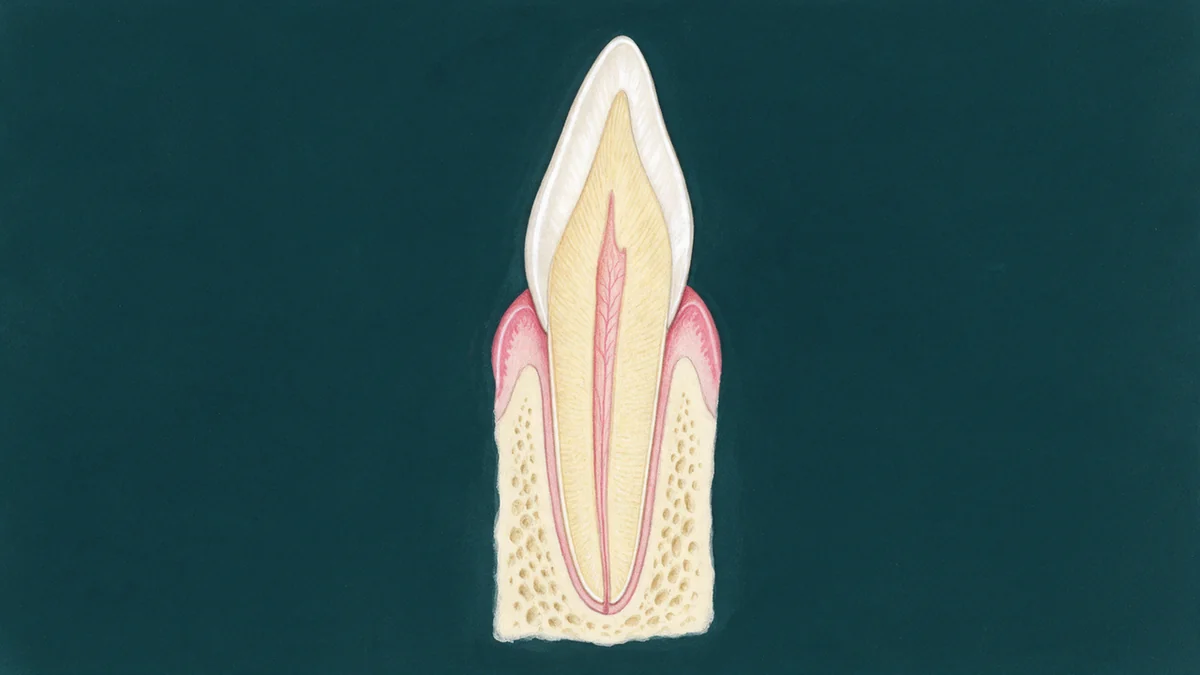 how do dental veneers work