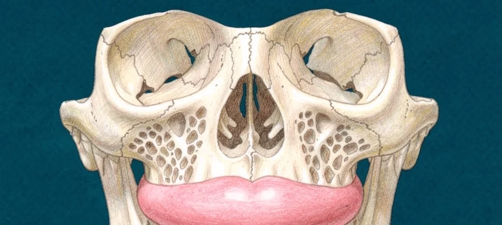 how do zygomatic implants work