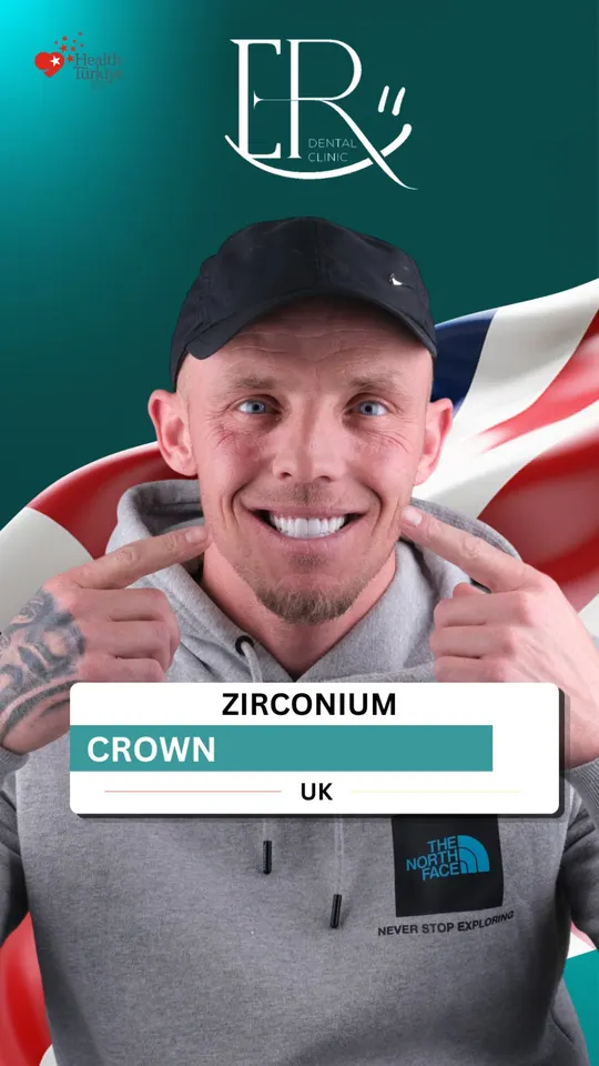 Best Turkey teeth – patient from the UK, video 4