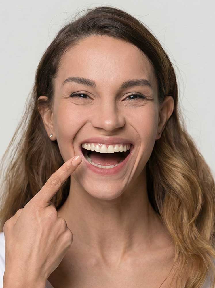 Dental Veneers in Istanbul, Turkey