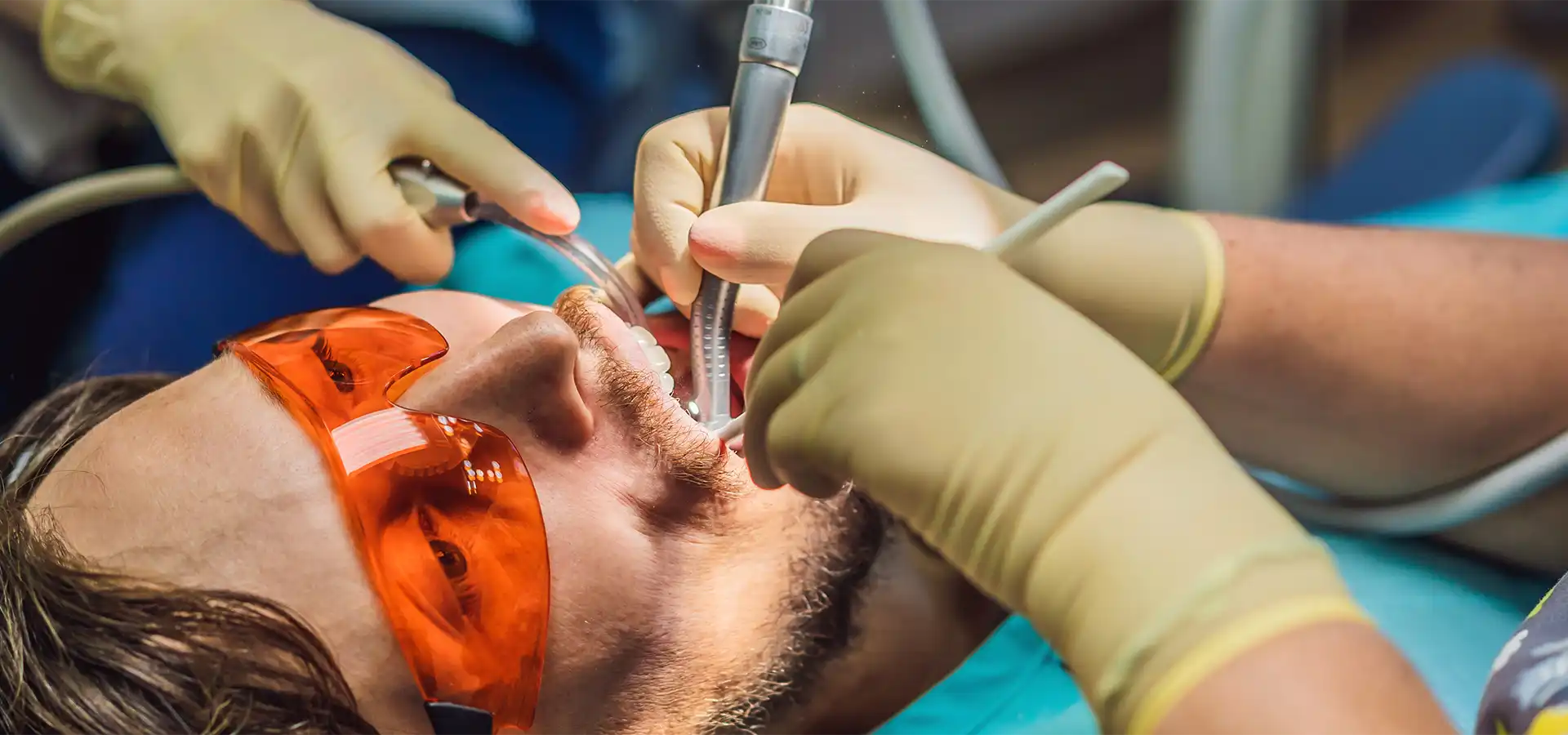 Root Canal Treatment in Istanbul, Turkey