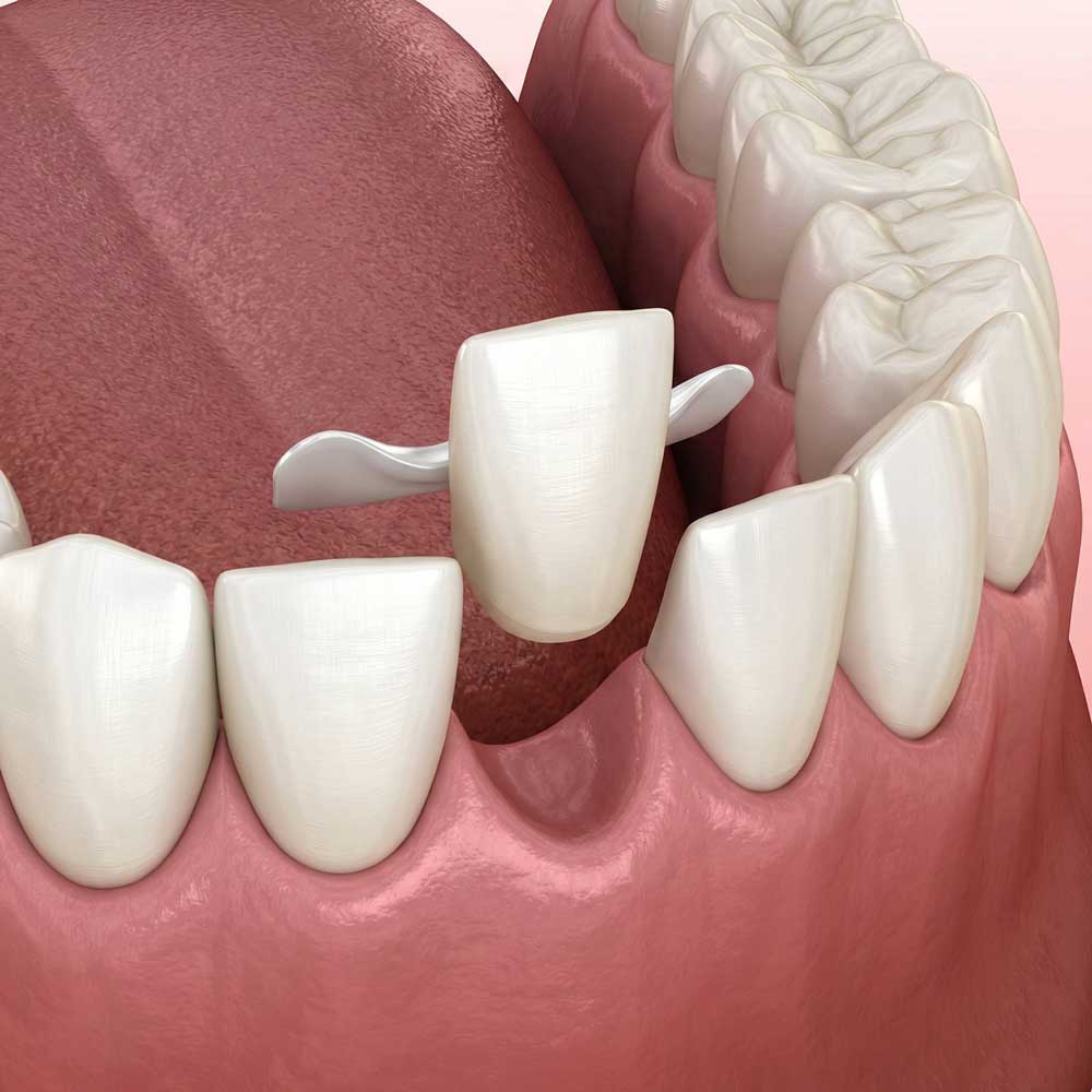 Maryland Bridges istanbul turkey